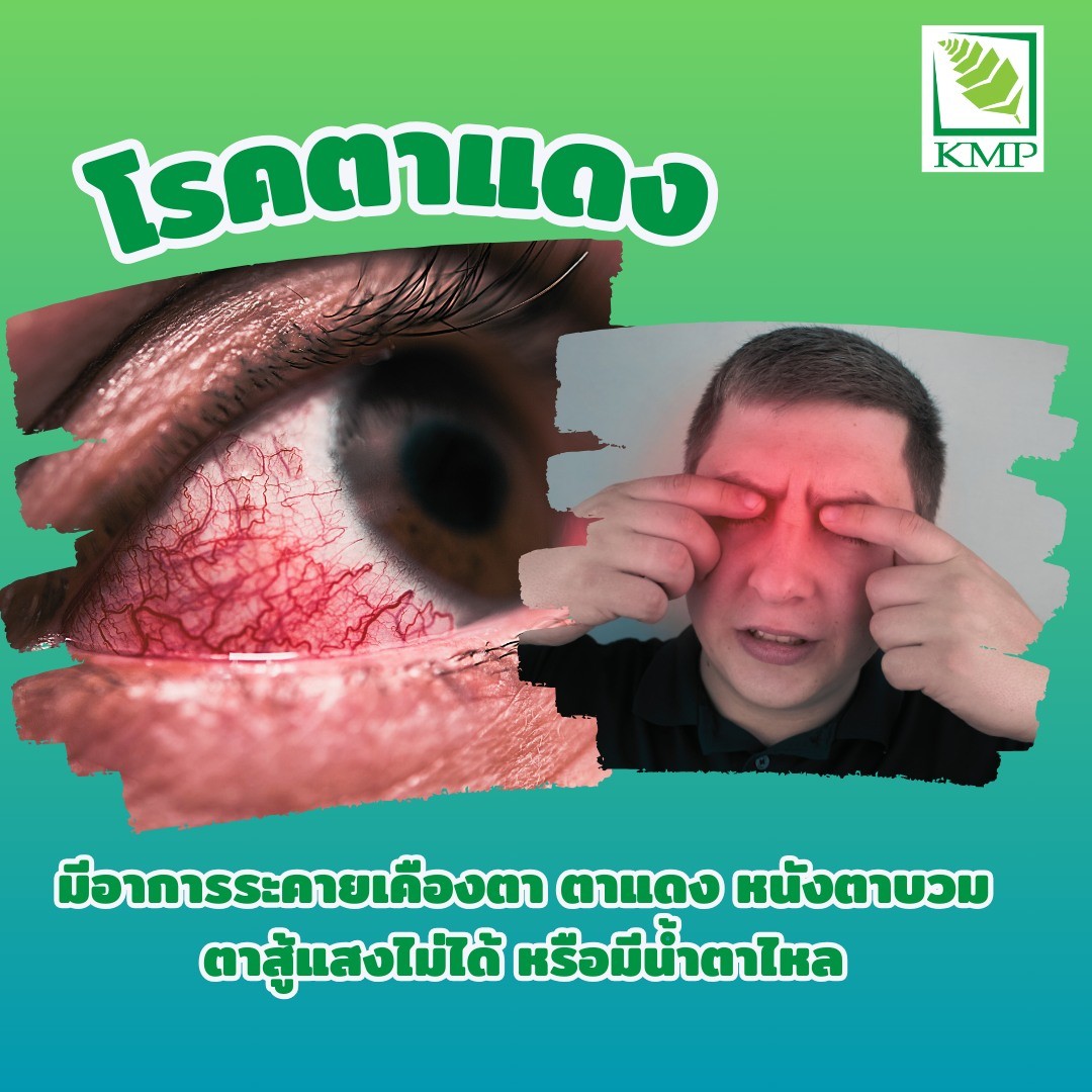 ตาแดง
